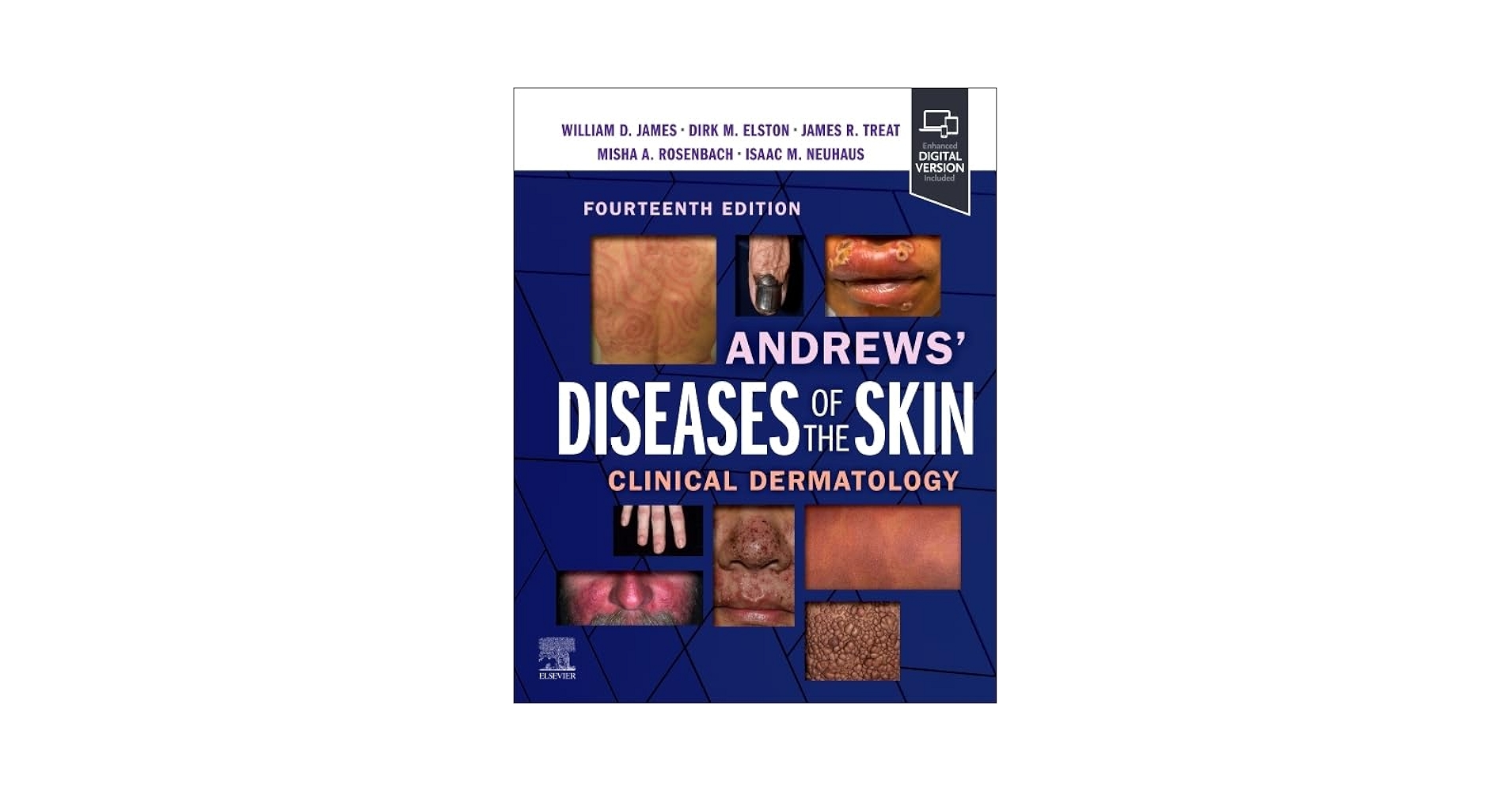 Andrews' Diseases of the Skin: Clinical Dermatology